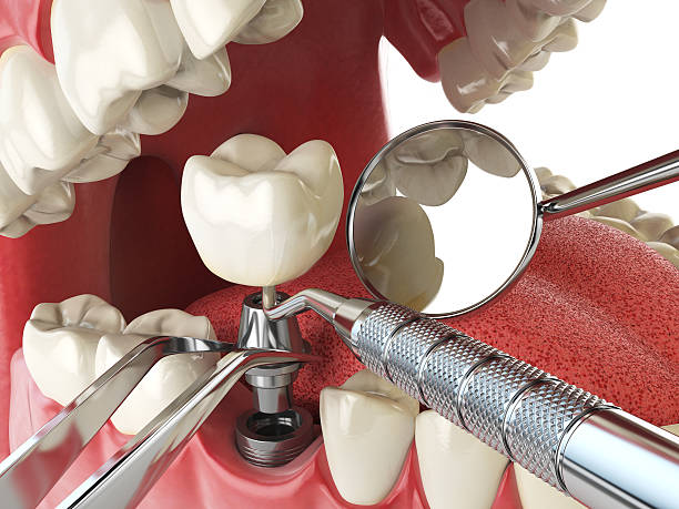 Best Emergency Treatment for Toothache in Oill, NE