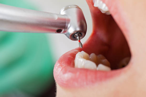 Best Emergency Broken Tooth Repair in Oill, NE